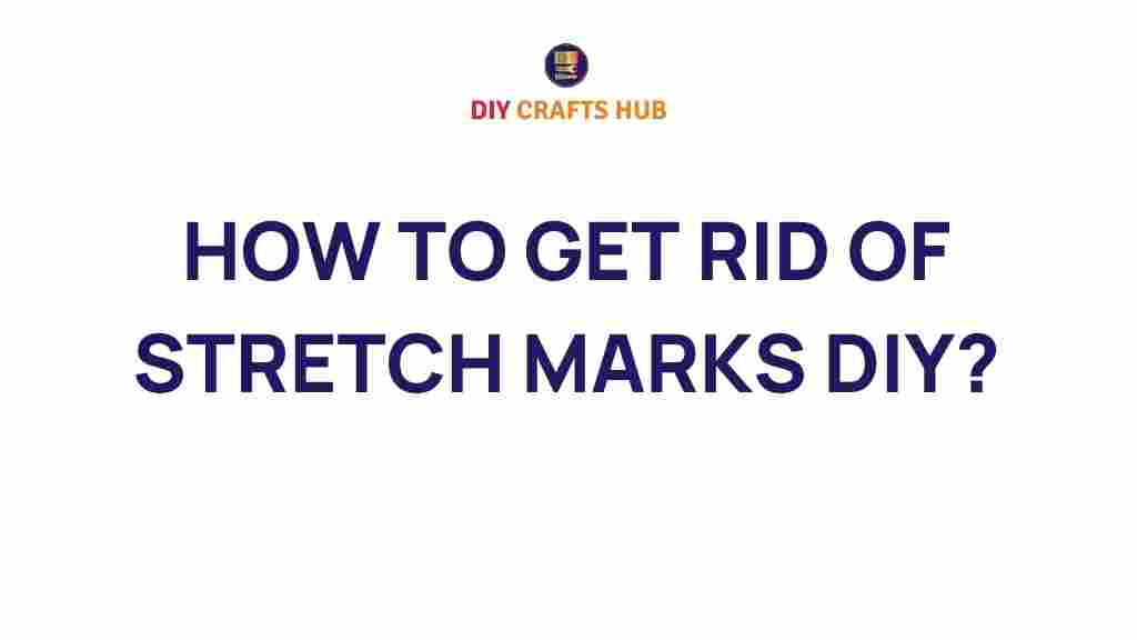 how-to-get-rid-of-stretch-marks-diy