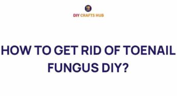 Say Goodbye to Toenail Fungus: DIY Remedies That Work